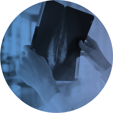 hm-services-circle-img